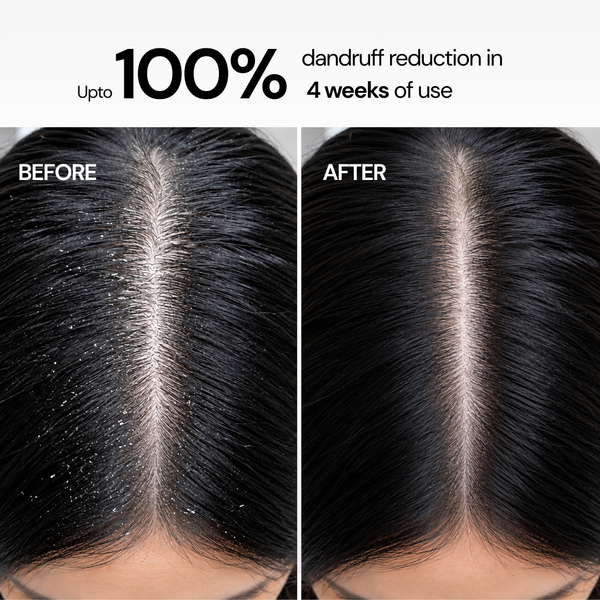 Anti-Dandruff Flake Control Conditioning Shampoo