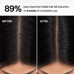 Hairfall Control Strengthening Conditioning Shampoo