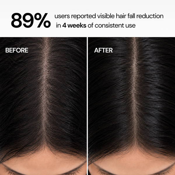 Hairfall Control Strengthening Conditioning Shampoo