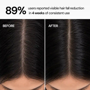 Hairfall Control Shampoo with 1% Saw Palmetto & 0.5% Biotin for Thinning & Breakage - 200 ml
