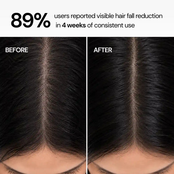 Hairfall Control Shampoo with 1% Saw Palmetto & 0.5% Biotin for Thinning & Breakage - 200 ml