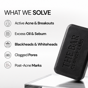 Anti Acne Soap - Pack of 4