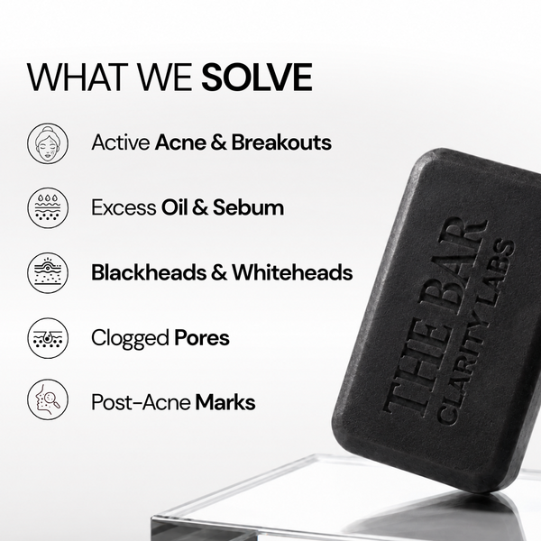 Anti Acne Soap - Pack of 4