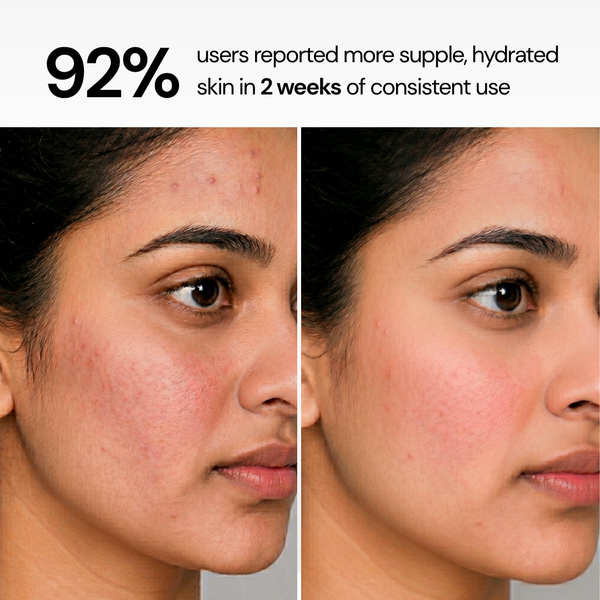 Sensitive Skin Syndet Bar - Pack of 4