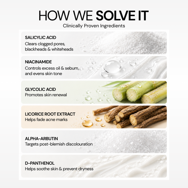 Acne Control Oil Balancing Serum Face Wash