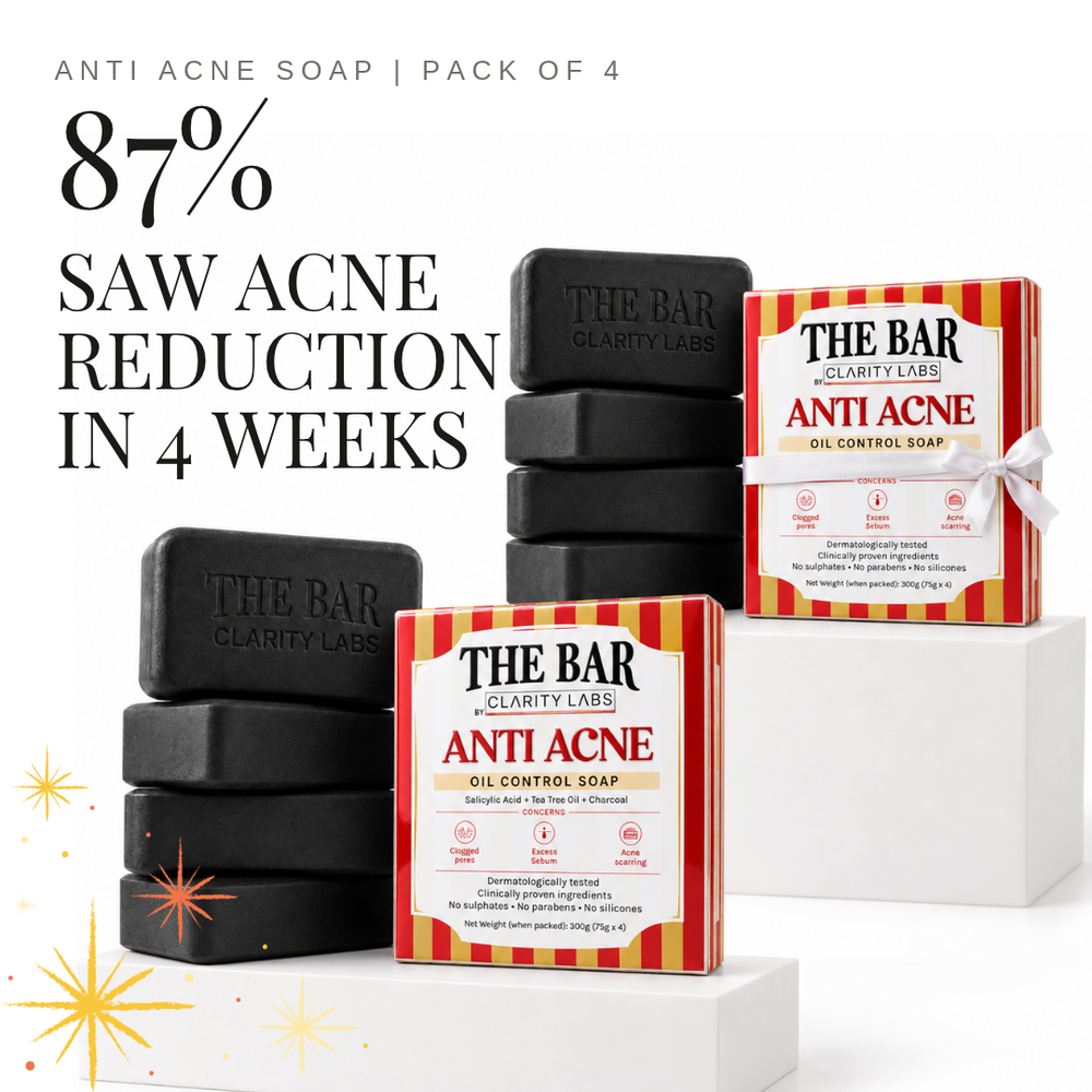 Anti Acne Soap with 1% Salicylic Acid & 0.5% Activated Charcoal | Pack of 4