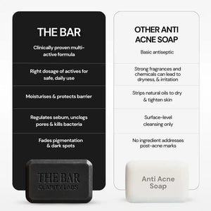 Anti Acne Soap with 1% Salicylic Acid & 0.5% Activated Charcoal | Pack of 4