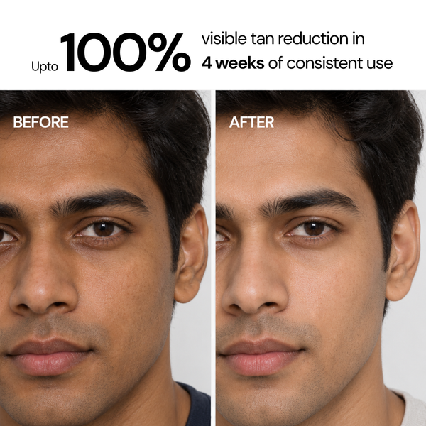 Acne Control Face Wash with 2% Salicylic Acid & 2% Niacinamide - 200 ml